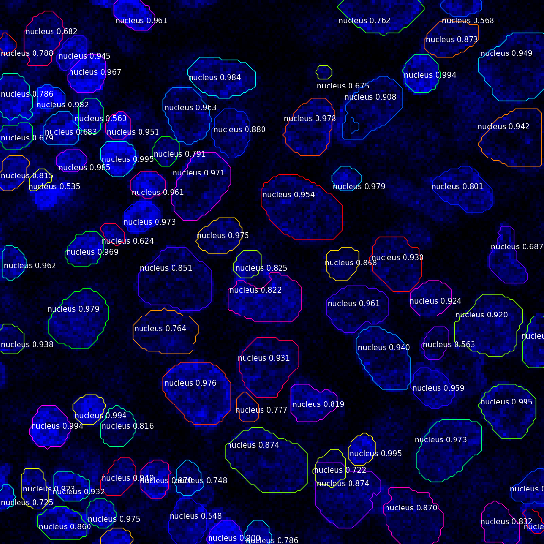 Instance Segmentation (Microscopy) - Miljan Vukadinovic